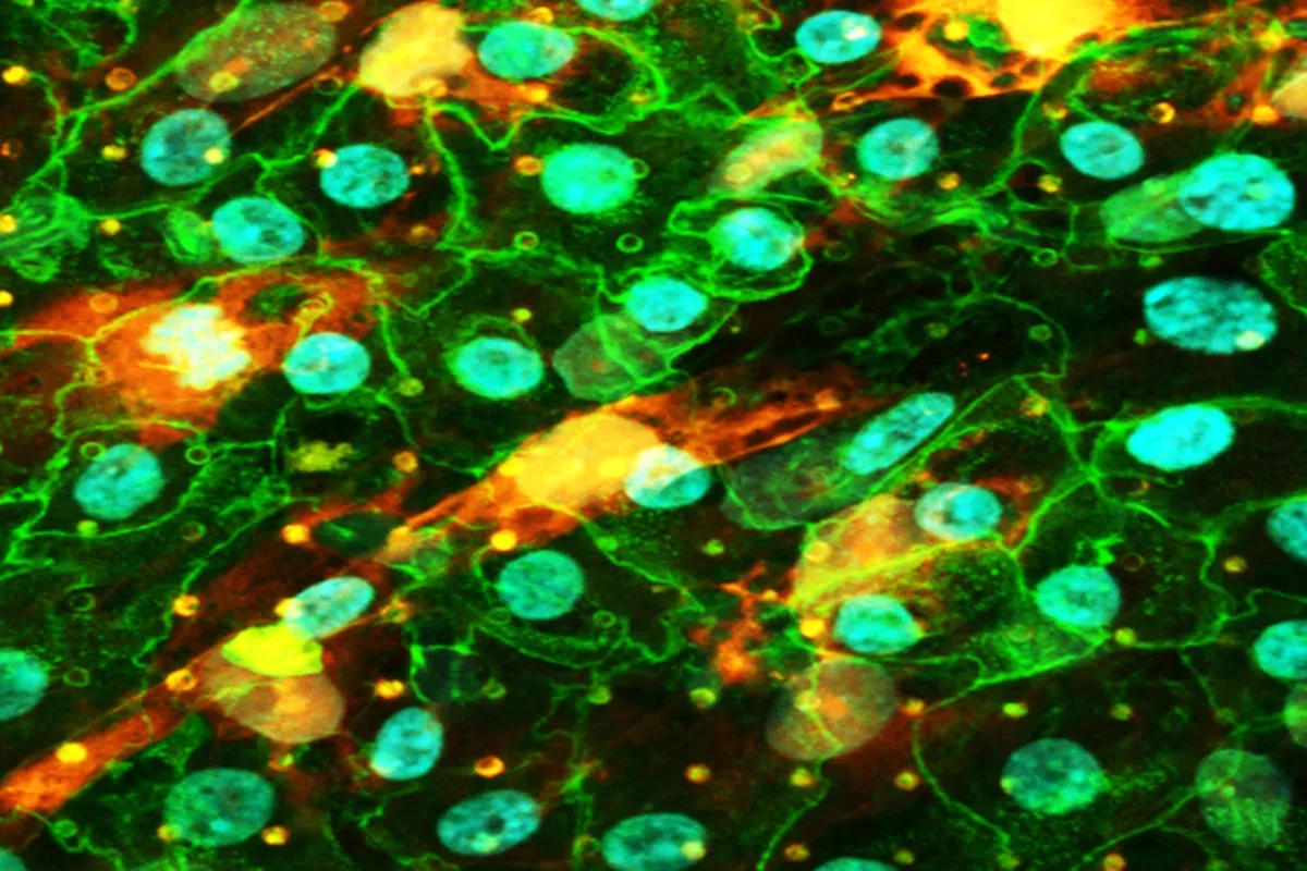 Human lung cells on the chip, under fluorescence