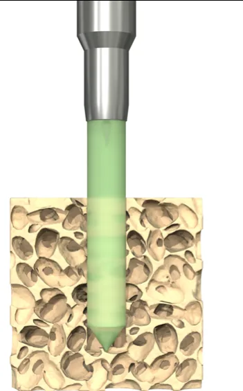 Step one: the sonotrode drives the thermoplastic implant into a pre-drilled hole